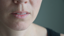 Close up of ladies mouth with dry lips