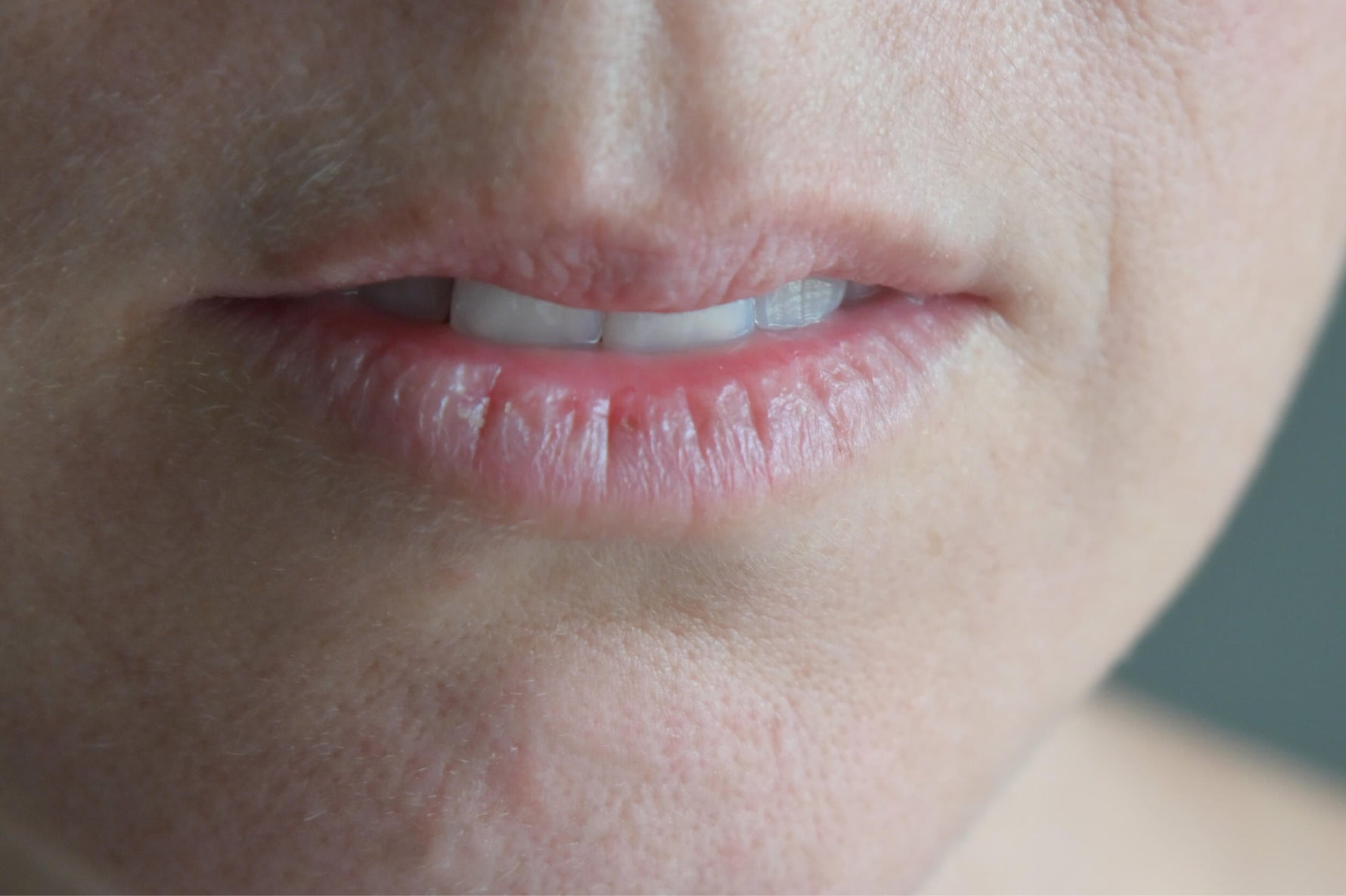 Dry mouth - what's that then?